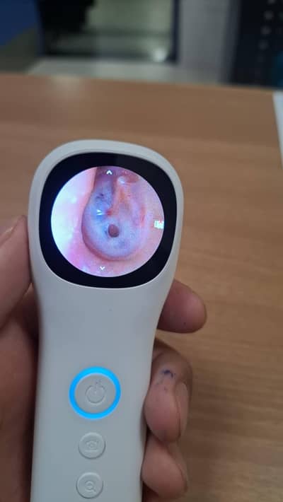 portable Rechargeable Video Otoscope