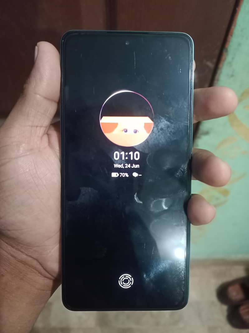 Tecno CAMON 20 1