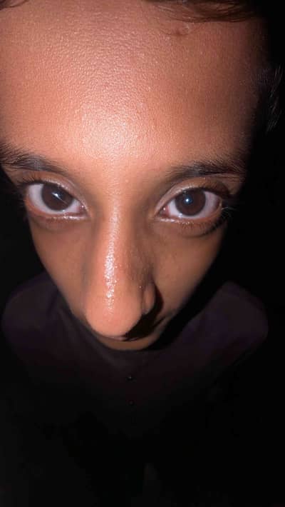 Bilal