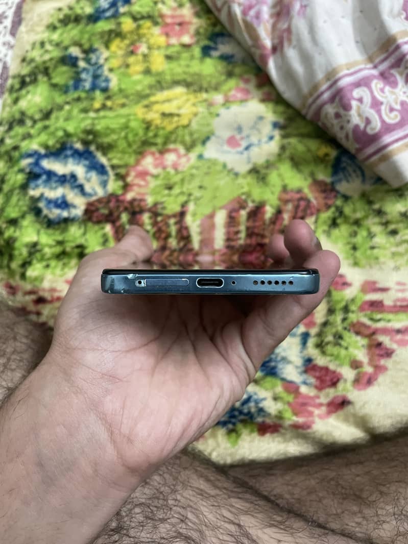 Xiaomi Redmi Note 11 Pro 5