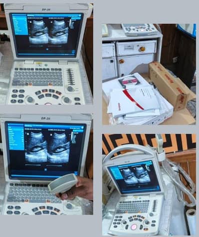 Ultrasound machine Mindry DP-20 with bettery backup+ box