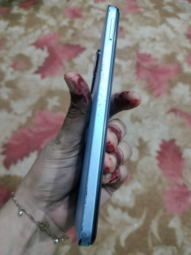 Itel A70 2
