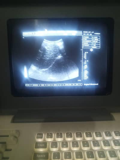 Portable Ultrasound machine for Sale