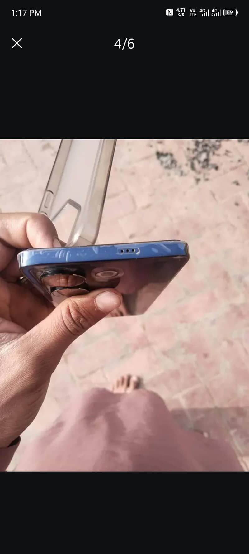 Tecno CAMON 20 1