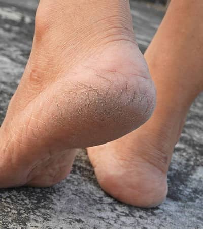 feetup
