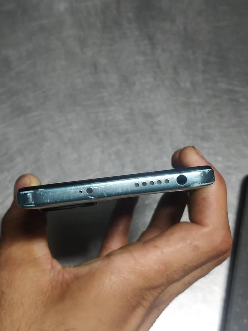 Xiaomi Redmi Note 11 3