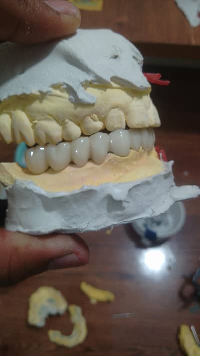 need a female manager in dental lab