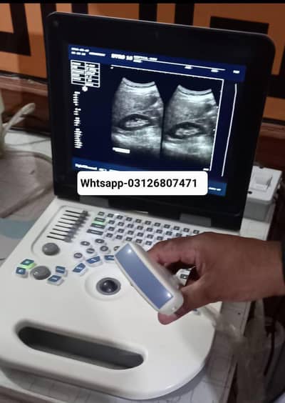 Ultrasound machine  New Nyro-10 bettery backup+ box