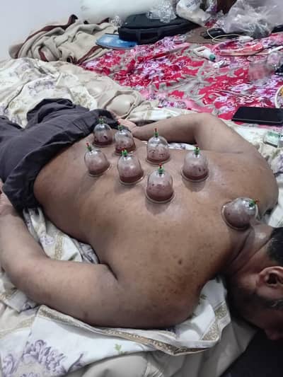 Home Care Physiotherapy and Hijama center