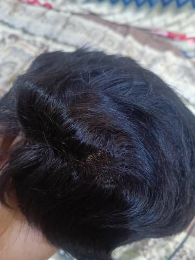 Hair patch premium quality