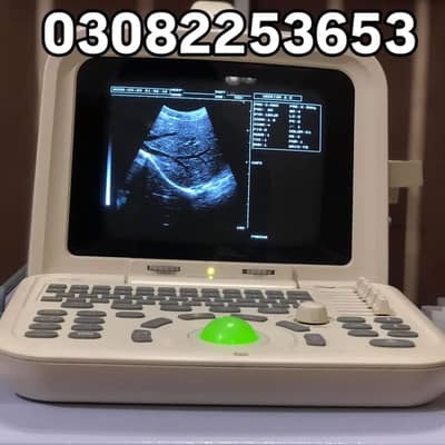 Ultrasound Machine
