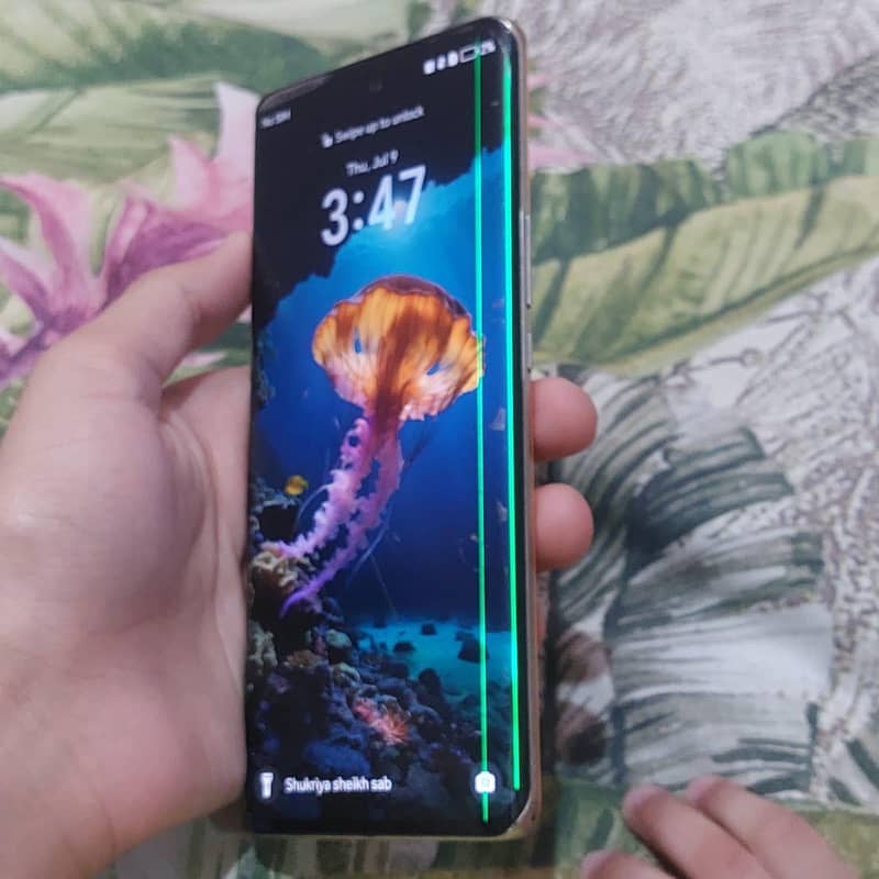 Honor X9b 7