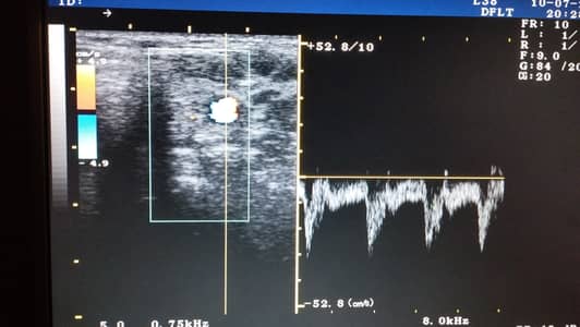 Ultrasound machine for sale