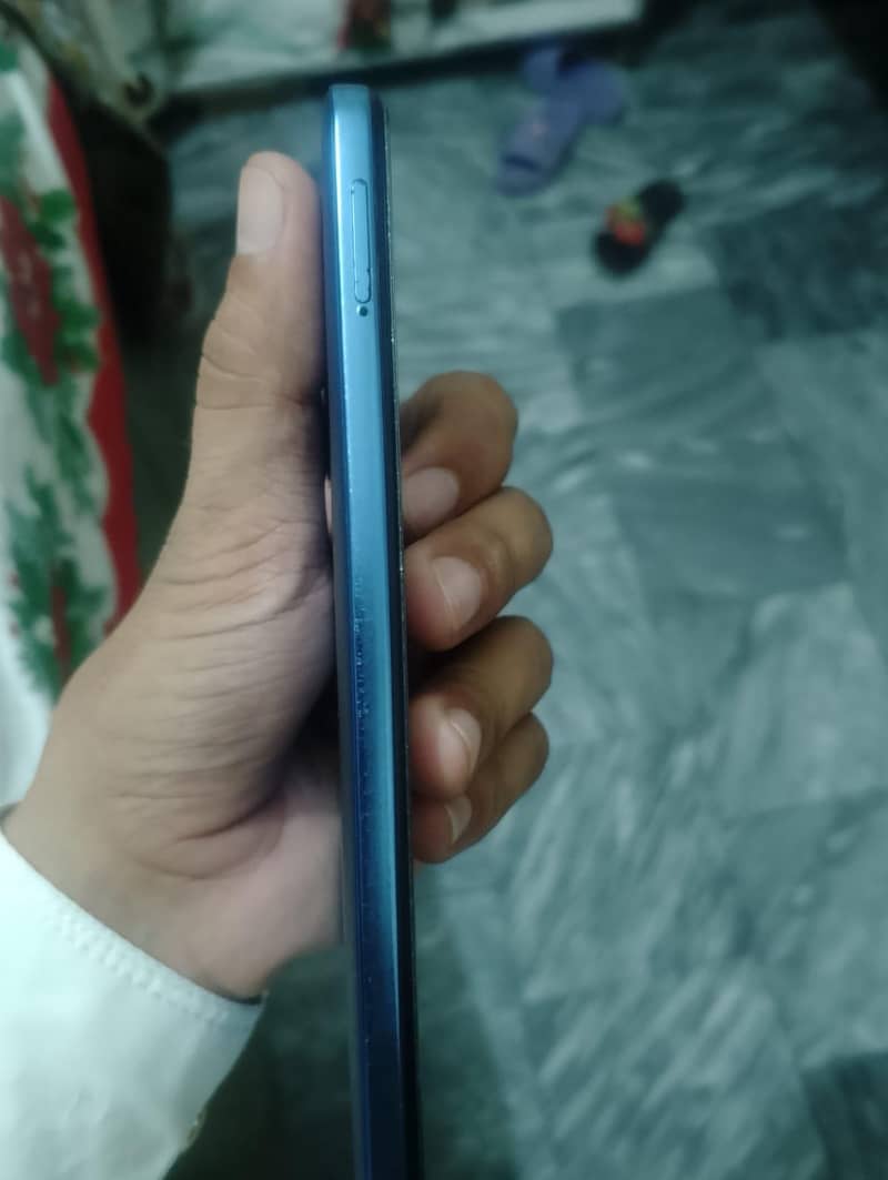 Xiaomi Redmi Note 11 6