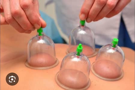 HIJAMA cupp