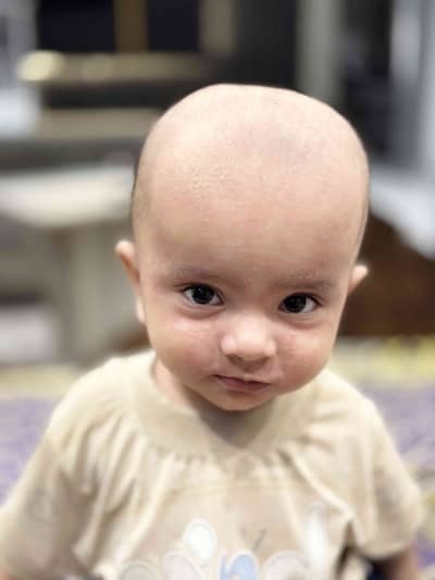 Ali