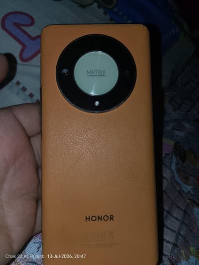 Honor X9b