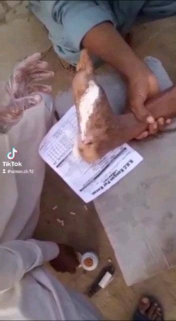 زخموں والی شوگر کا شرطیہ علاج 6