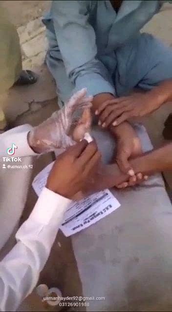 زخموں والی شوگر کا شرطیہ علاج 7