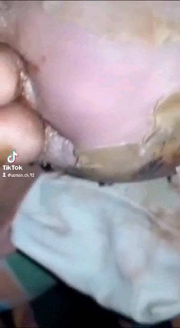 زخموں والی شوگر کا شرطیہ علاج 8