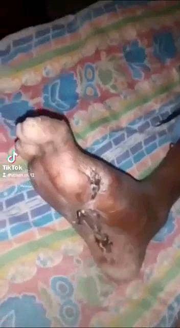 زخموں والی شوگر کا شرطیہ علاج 9