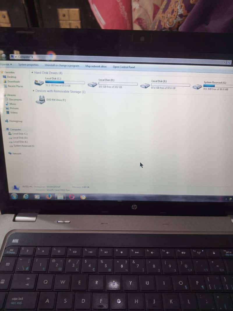 Hp vision 3