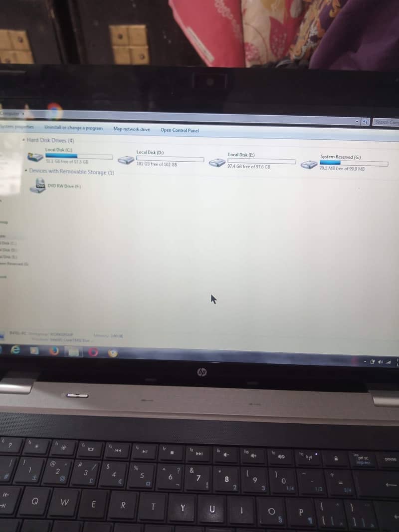 Hp vision 11