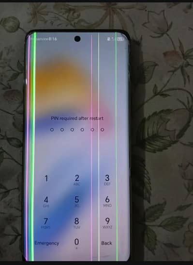 Honor X9b