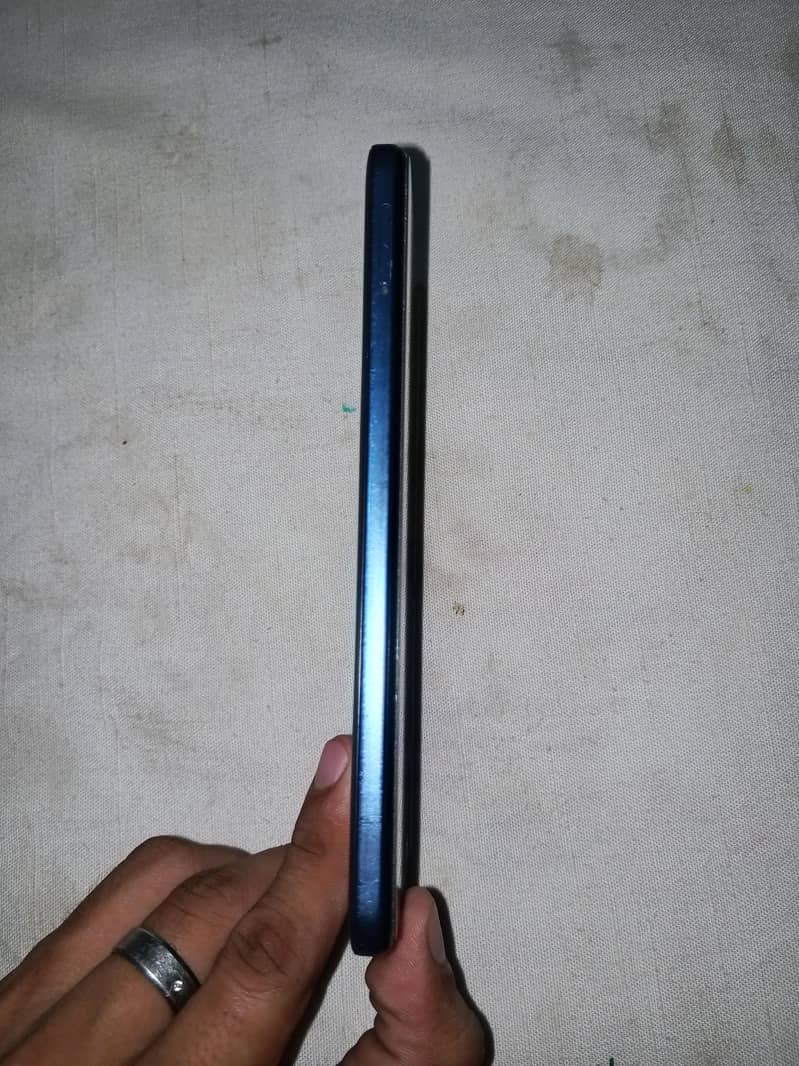 Xiaomi Redmi Note 11 6