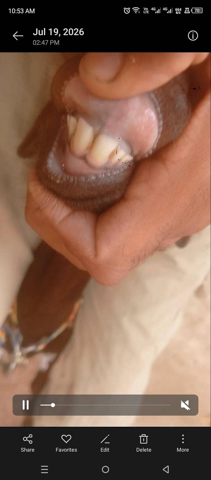 Bakri 5