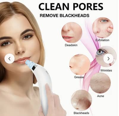 Derma Suction Facial SPA Blackhead Remover Machine 4 in 1 Black Head