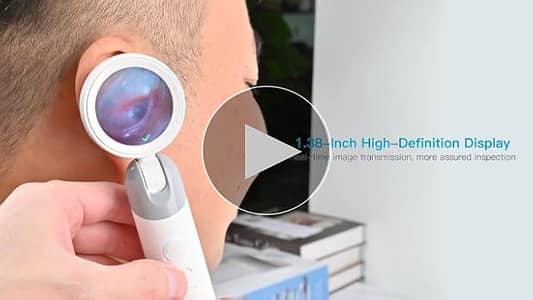 Digital otoscope