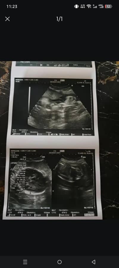 Female Ultrasound Technologist