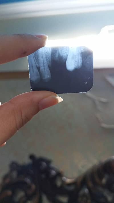 dental x-ray
