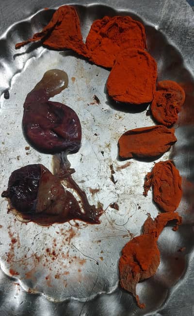 Cats Placenta