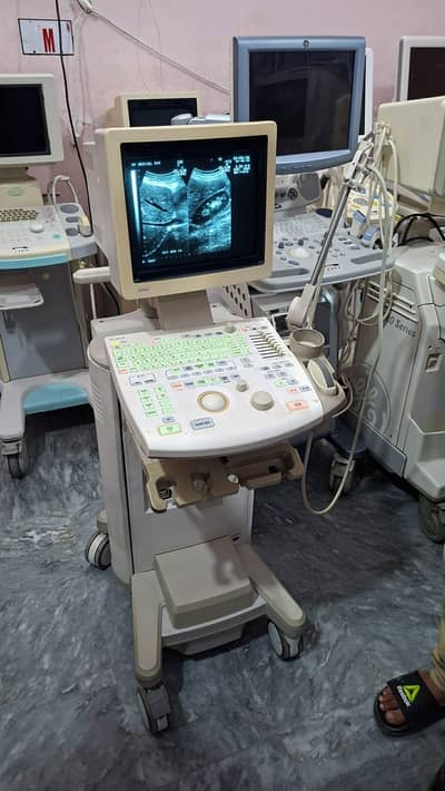 Aloka simple japanese ultrasound machine