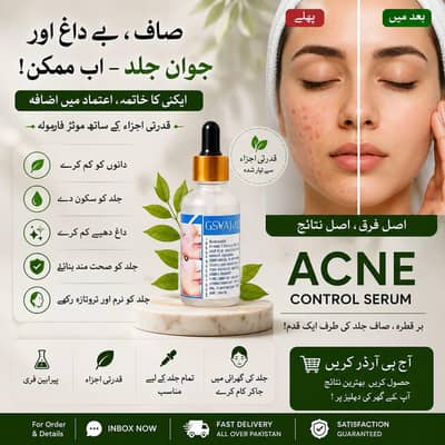 ACNE control serum