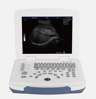 DAWEI 580 Portable USG machine