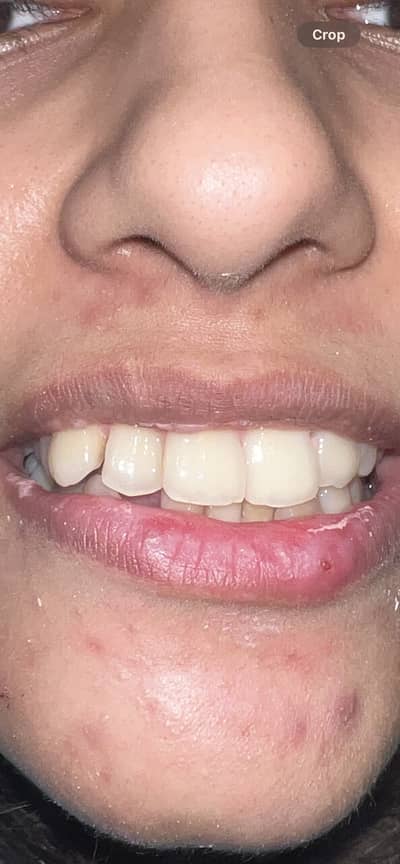 Female Trained Dental Assistant