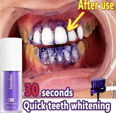 Teeth Whitening V34