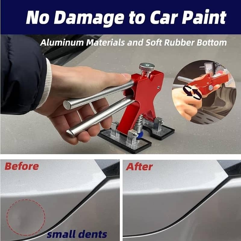 pdr Dent puller kit 2