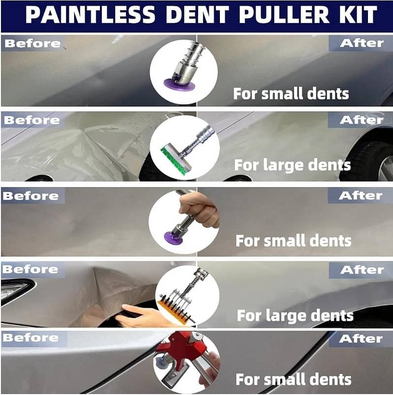 pdr Dent puller kit 4