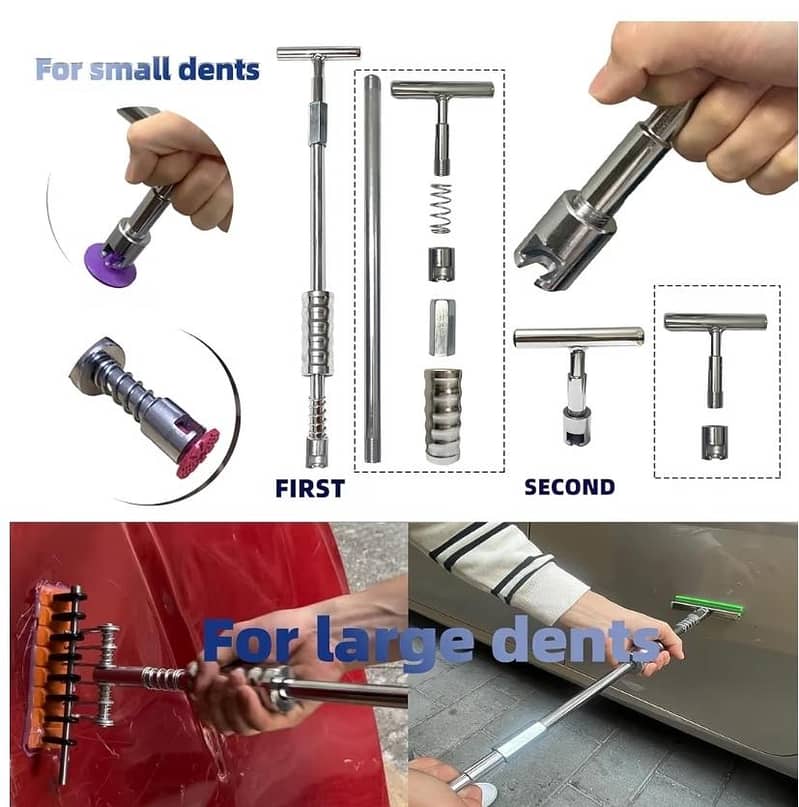 pdr Dent puller kit 5