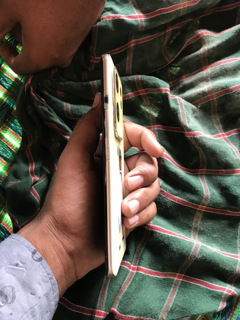 Infinix Zero 30 1