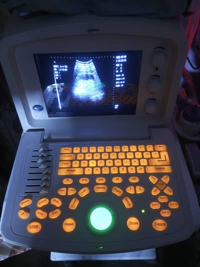 Ultrasound