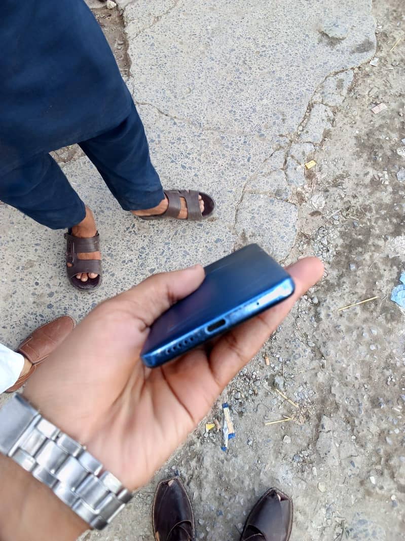 Redme note 11 3