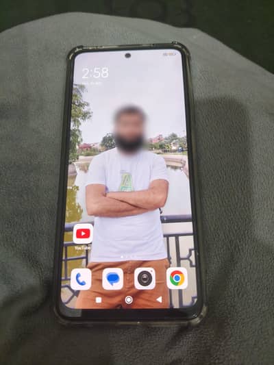 Xiaomi Redmi Note 11