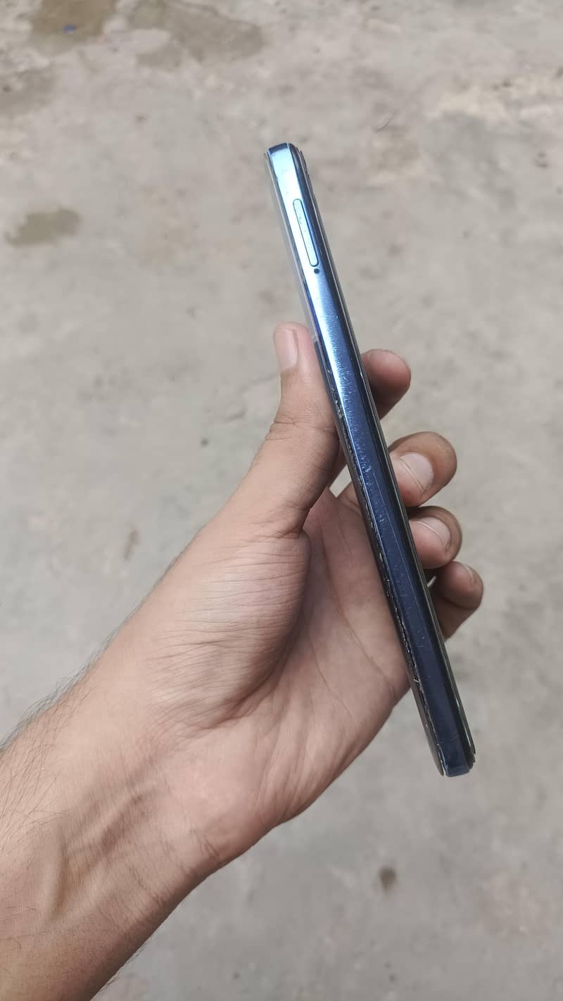 Redmi Note 11 6