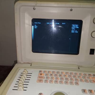 B mod Ultrasound