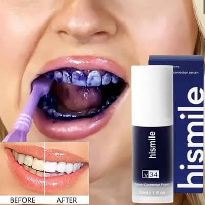  Hismile V34 Teeth Colour Corrector Serum 